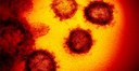 Coronavirus.jpg Coronavirus.jpg